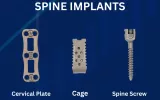Spine Implants